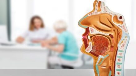 Anatomical-model-of-nasal-and-oral-cavity-treated-by-radiofrequency-ablation