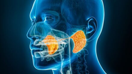 Digital-illustration-of-parotid-glands Digital-illustration-of-parotid-glands